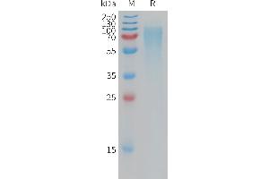 Human ANPRB Protein, His Tag on SDS-PAGE under reducing condition. (NPR2 Protein (AA 23-458) (His tag))