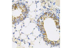 Immunohistochemistry of paraffin-embedded mouse lung using CEACAM5 antibody (ABIN6291892) (40x lens). (CEACAM5 anticorps)