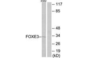 Western blot analysis of extracts from K562 cells, using FOXE3 Antibody. (FOXE3 anticorps  (AA 81-130))