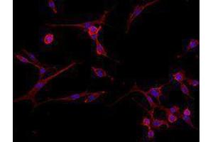 Immunofluorescence (IF) image for Goat anti-Rat IgG antibody (Alexa Fluor 594) (ABIN2667001) (Chèvre anti-Rat IgG Anticorps (Alexa Fluor 594))