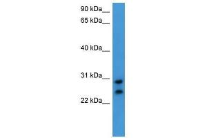 Western Blot showing CEACAM7 antibody used at a concentration of 1-2 ug/ml to detect its target protein. (CEACAM7 anticorps  (C-Term))