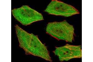 Fluorescent image of U251 cells stained with VCP antibody at 1:25. (VCP anticorps)