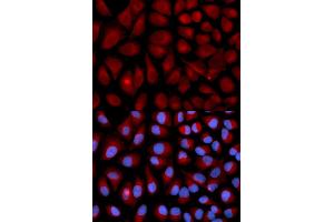 Immunofluorescence analysis of U2OS cells using VIM antibody (ABIN5971408). (Vimentin anticorps)