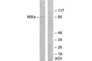 Western blot analysis of extracts from 293 cells, treated with EGF, using IKK-alpha (Ab-23) Antibody. (IKK alpha anticorps  (AA 15-64))
