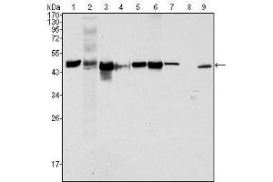 Western Blot showing CK18 antibody used against Hela (1), NIH/3T3 (2), A549 (3), Jurkat (4), MCF-7 (5), HepG2 (6), A431 (7), HEK293 (8) and K562 (9) cell lysate. (Cytokeratin 18 anticorps  (AA 391-483))