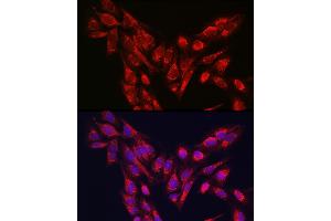 Immunofluorescence analysis of U-2 OS cells using PINK1 Rabbit pAb (ABIN6128457, ABIN6145665, ABIN6145667 and ABIN6215214) at dilution of 1:250 (40x lens). (PINK1 anticorps  (AA 282-581))