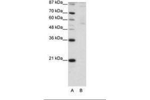 Image no. 1 for anti-Zinc Finger Protein 92 (ZNF92) (C-Term) antibody (ABIN203189) (ZNF92 anticorps  (C-Term))