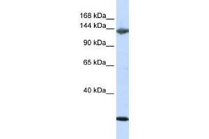WB Suggested Anti-JAG2 Antibody Titration:  0. (JAG2 anticorps  (N-Term))