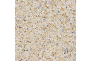 Immunohistochemistry of paraffin-embedded human liver using PSAP antibody at dilution of 1:200 (x400 lens) (Prosaposin anticorps)