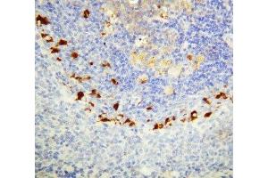 IHC-P: SOCS1 antibody testing of rat spleen tissue (SOCS1 anticorps  (C-Term))