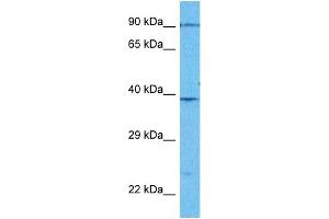 Host:  Rabbit  Target Name:  PLMN  Sample Type:  Jurkat Whole Cell lysates  Antibody Dilution:  1. (PLG anticorps  (Middle Region))