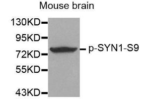Western blot analysis of extracts from mouse Brain tissue using Phospho-SYN1-S9 antibody (ABIN2987713). (SYN1 anticorps  (pSer9))