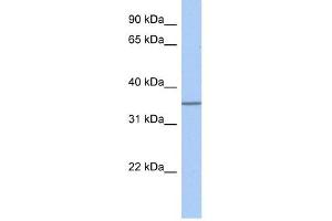 GLT6D1 antibody used at 1 ug/ml to detect target protein. (GLT6D1 anticorps  (Middle Region))