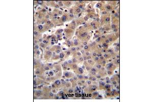 GUSB Antibody (C-term) (ABIN656383 and ABIN2845678) immunohistochemistry analysis in formalin fixed and paraffin embedded human liver tissue followed by peroxidase conjugation of the secondary antibody and DAB staining. (Glucuronidase beta anticorps  (C-Term))