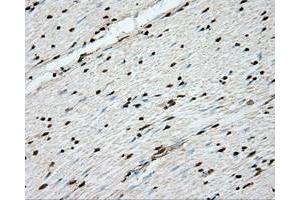 Immunohistochemical staining of paraffin-embedded Kidney tissue using anti-ERCC1 mouse monoclonal antibody. (ERCC1 anticorps)