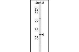 Western blot analysis in Jurkat cell line lysates (35ug/lane). (TMED8 anticorps  (AA 154-182))