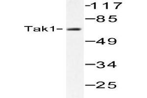 Western blot (WB) analysis of Tak1 antibody in extracts from HepG2 cells. (TR4 anticorps)