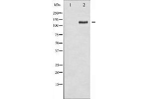 Western blot analysis of FAK phosphorylation expression in 293 whole cell lysates,The lane on the left is treated with the antigen-specific peptide. (FAK anticorps  (pTyr925))