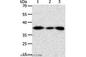 Western blot analysis of Human liver cancer tissue, hela cell and human fetal kidney tissue, using AKR1A1 Polyclonal Antibody at dilution of 1:450 (AKR1A1 anticorps)