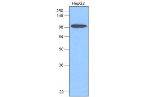 Western Blotting (WB) image for anti-Hexokinase 1 (HK1) antibody (ABIN306422) (Hexokinase 1 anticorps)