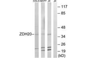 Western blot analysis of extracts from Jurkat/MCF-7/COLO cells, using ZDHHC20 Antibody. (ZDHHC20 anticorps  (AA 72-121))