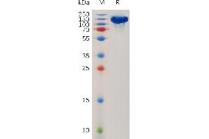 Human R Protein, hFc Tag on SDS-PAGE under reducing condition. (ROBO1 Protein (AA 26-897) (Fc Tag))