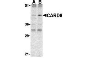 Western Blotting (WB) image for anti-Caspase Recruitment Domain Family, Member 8 (CARD8) (C-Term) antibody (ABIN1030312) (CARD8 anticorps  (C-Term))