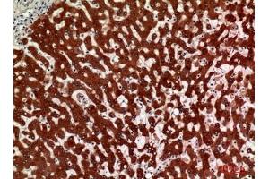 Immunohistochemical analysis of paraffin-embedded human-liver, antibody was diluted at 1:100. (HSD11B1 anticorps  (N-Term))