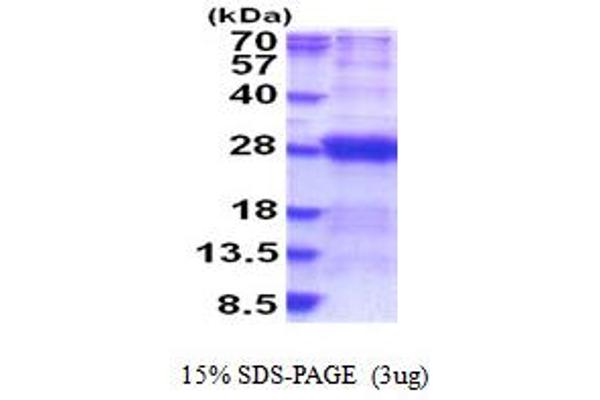 DCTN6 Protein (AA 1-190) (His tag)