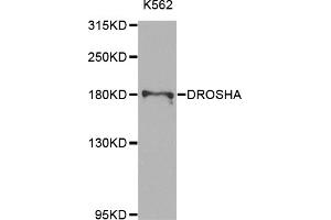 Western blot analysis of extracts of K-562 cells, using DROSHA antibody (ABIN5975795) at 1/1000 dilution. (DROSHA anticorps)