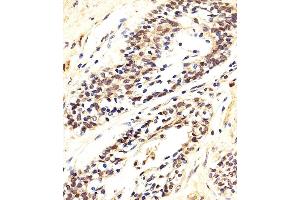 Immunohistochemical analysis of paraffin-embedded H. (AKT 1/2/3 anticorps  (AA 278-312))