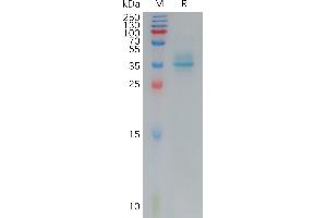 Human A Protein, hFc Tag on SDS-PAGE under reducing condition. (Angiotensin II Type-1 Receptor Protein (AA 1-27) (Fc Tag))