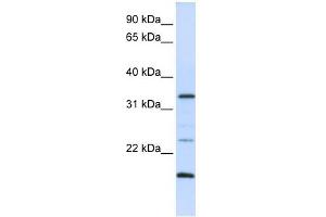 Western Blot showing ARGFX antibody used at a concentration of 1-2 ug/ml to detect its target protein. (ARGFX anticorps  (N-Term))