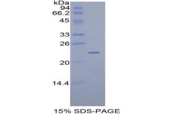 Talin Protein (TLN)