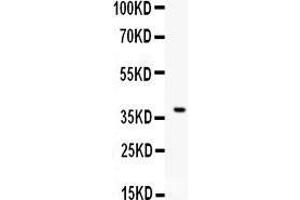 Anti- CD86 Picoband antibody, Western blotting All lanes: Anti CD86  at 0. (CD86 anticorps  (AA 24-329))