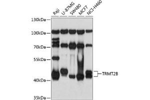 Western blot analysis of extracts of various cell lines, using TRMT2B antibody  at 1:1000 dilution. (TRMT2B anticorps  (AA 1-250))