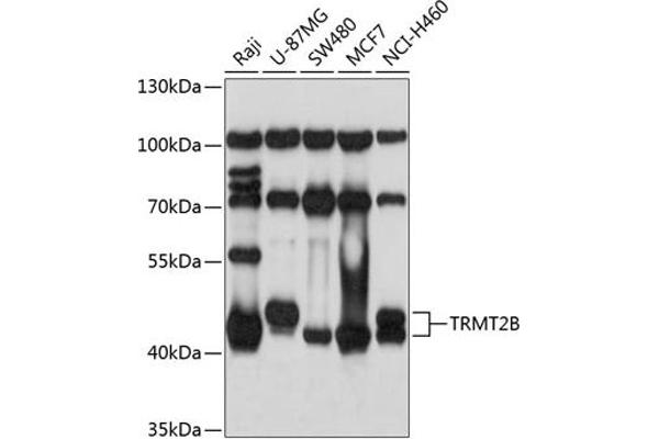 TRMT2B anticorps  (AA 1-250)