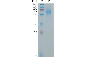 Human EGFRVIII Protein, His Tag on SDS-PAGE under reducing condition. (EGFRviii Protein (AA 25-645) (His tag))