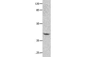 Western blot analysis of Human leiomyosarcoma tissue, using GNA11 Polyclonal Antibody at dilution of 1:450 (GNA11 anticorps)