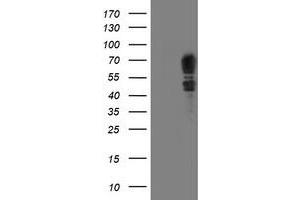 HEK293T cells were transfected with the pCMV6-ENTRY control (Left lane) or pCMV6-ENTRY SCHIP1 (Right lane) cDNA for 48 hrs and lysed. (SCHIP1 anticorps)