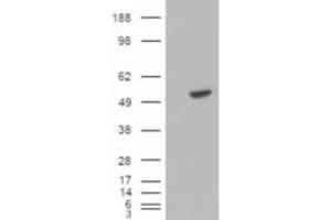 Western Blotting (WB) image for anti-B-Cell Linker (BLNK) (C-Term) antibody (ABIN2465185) (B-Cell Linker anticorps  (C-Term))