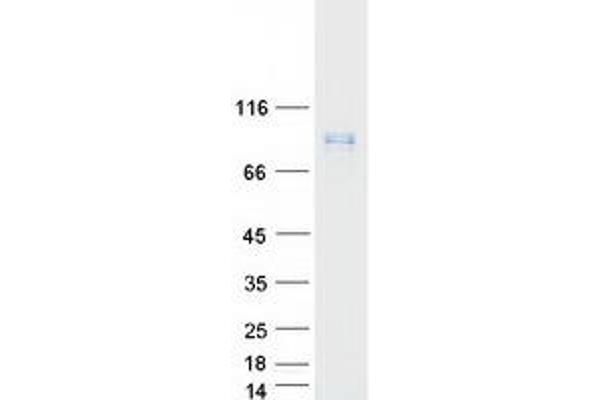 Leiomodin 1 Protein (LMOD1) (Myc-DYKDDDDK Tag)