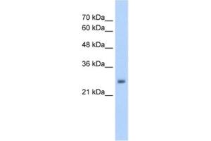 Western Blotting (WB) image for anti-NMDA Receptor Synaptonuclear Signaling and Neuronal Migration Factor (NSMF) antibody (ABIN2462581) (NMDA Receptor Synaptonuclear Signaling and Neuronal Migration Factor (NSMF) anticorps)