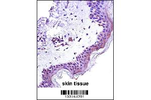 STAT2 Antibody immunohistochemistry analysis in formalin fixed and paraffin embedded human skin tissue followed by peroxidase conjugation of the secondary antibody and DAB staining. (STAT2 anticorps  (N-Term))