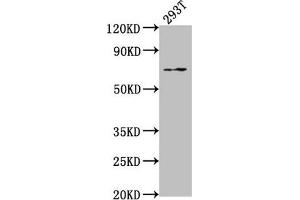 Western Blot Positive WB detected in: 293T whole cell lysate All lanes: PXN antibody at 1:2000 Secondary Goat polyclonal to rabbit IgG at 1/50000 dilution Predicted band size: 65, 61, 67, 47 kDa Observed band size: 65 kDa (Paxillin anticorps  (AA 28-45))