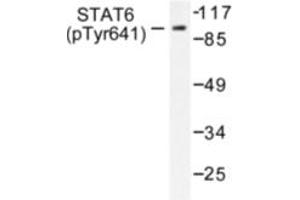 Image no. 1 for anti-Signal Transducer and Activator of Transcription 6, Interleukin-4 Induced (STAT6) (pTyr641) antibody (ABIN318133) (STAT6 anticorps  (pTyr641))