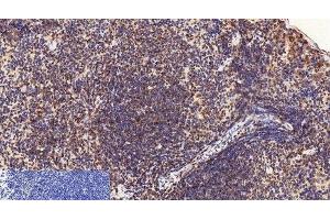 Immunohistochemistry of paraffin-embedded Mouse spleen tissue using CD2 Monoclonal Antibody at dilution of 1:200. (CD2 anticorps)