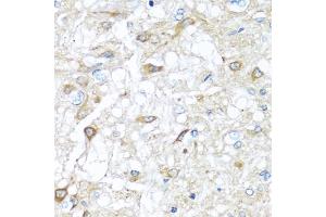 Immunohistochemistry of paraffin-embedded rat brain using RAC2 antibody. (RAC2 anticorps)