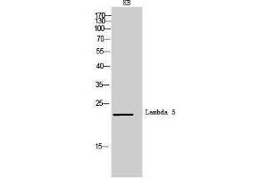 Western Blotting (WB) image for anti-Immunoglobulin lambda-Like Polypeptide 1 (IGLL1) (Internal Region) antibody (ABIN6285798) (IGLL1 anticorps  (Internal Region))