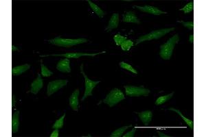 Immunofluorescence of purified MaxPab antibody to PSME3 on HeLa cell. (PSME3 anticorps  (AA 1-254))